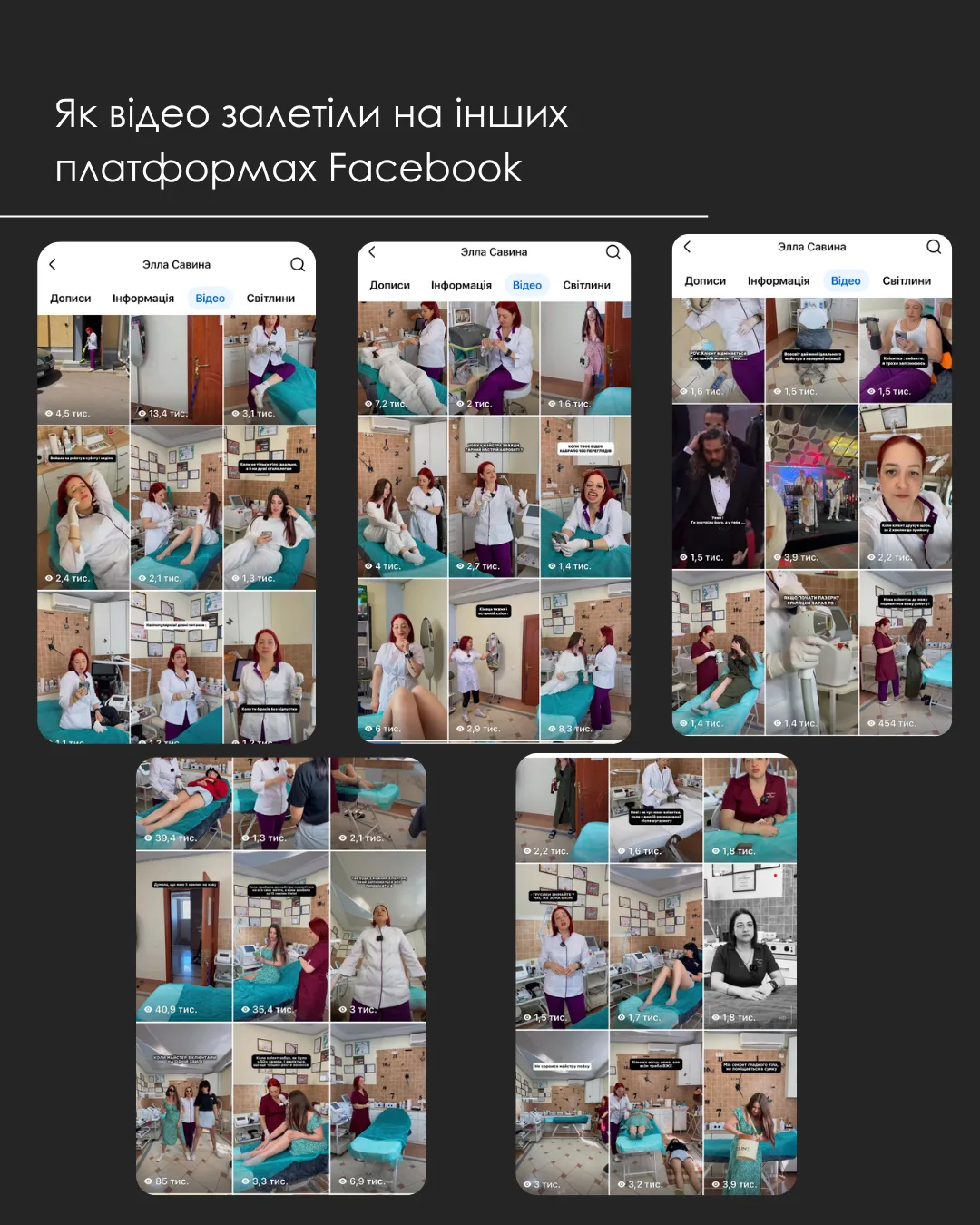 Органічні перегляди відео майстра лазерної епіляції у Facebook